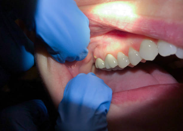Best Emergency Dental Care for Trauma or Injury in Westwego, LA