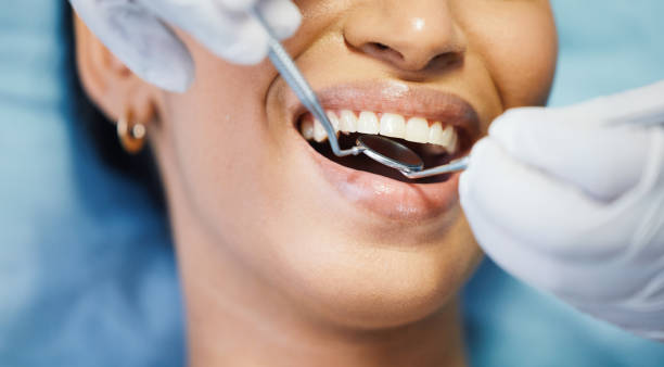 Best Emergency Root Canal Treatment in Westwego, LA